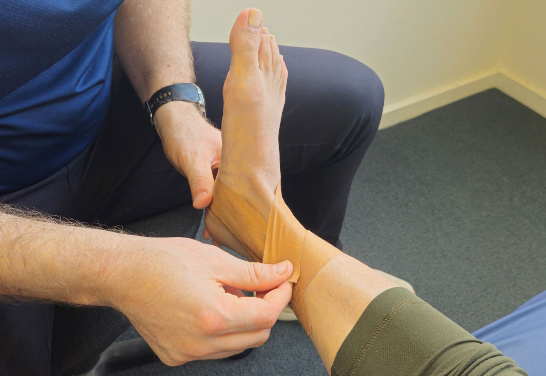 physio taping ankle in clinic